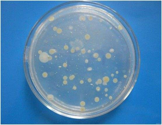 菌落总数,水质在线香蕉一区二区在线观看