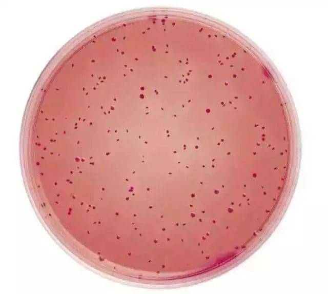 大肠菌群香蕉一区二区在线观看